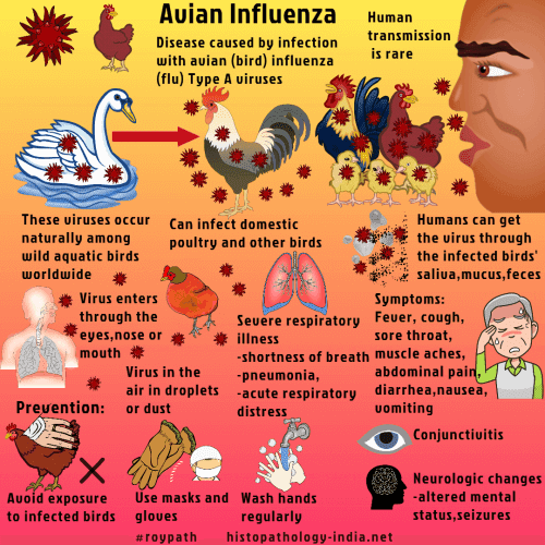 Bird Flu Epidemiology and Prevention Astral Hygiene